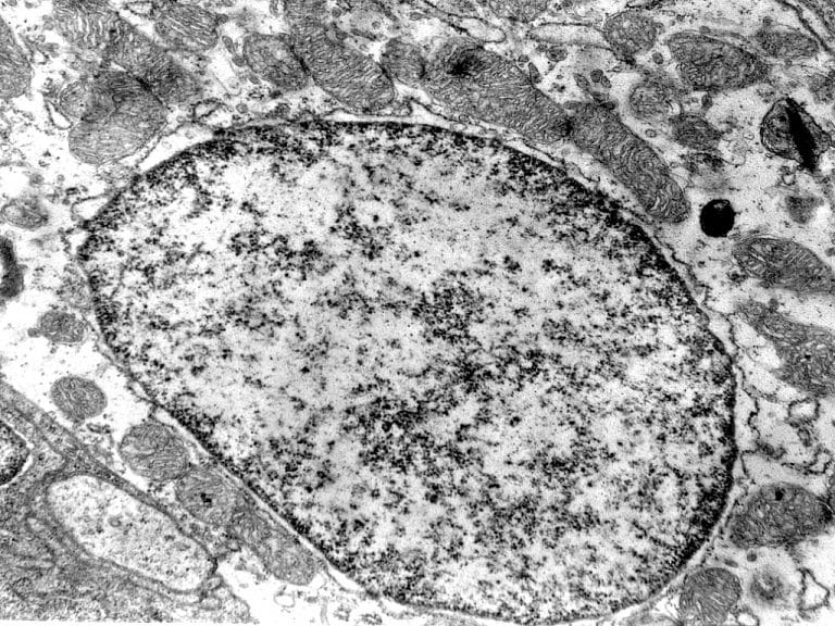 Nucleus Function Euchromatin Vs Heterochromatin TeachMePhys