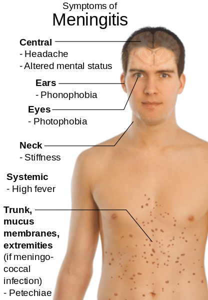 Barriers To Infection Teachmephysiology