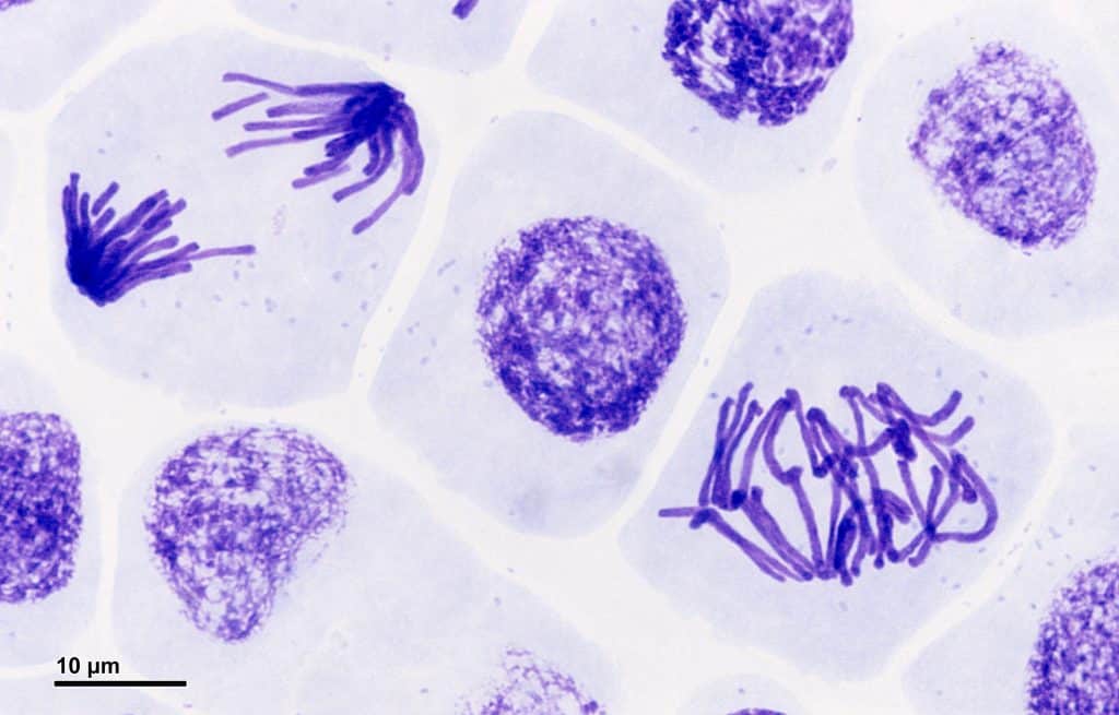 prophase mitosis