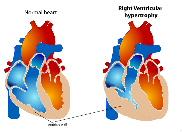 Specialised Pulmonary Circulation Oedema TeachMePhysiology