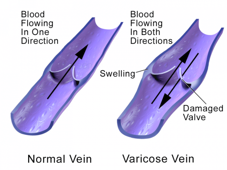 Venous Return Central Venous Pressure TeachMePhysiology