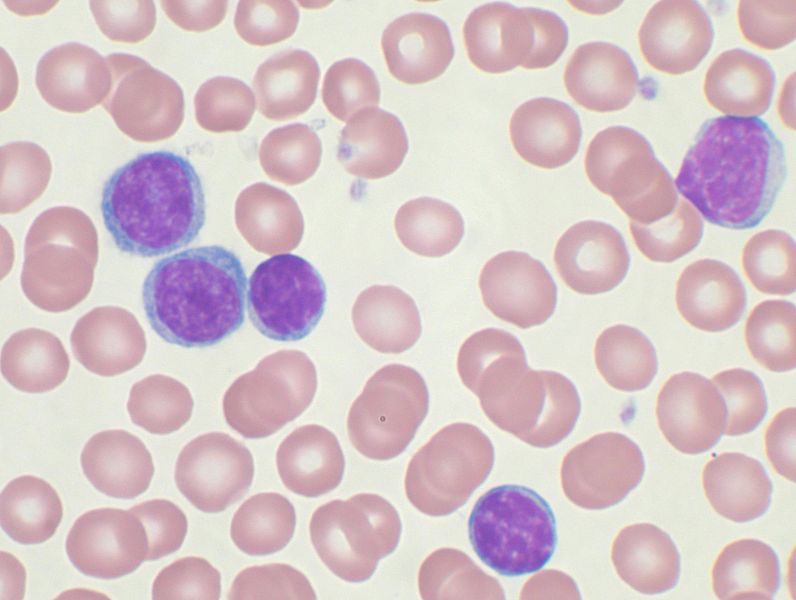 leukocytes histology