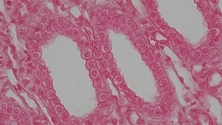 Epithelial Cells Simple Stratified Teachmephysiology