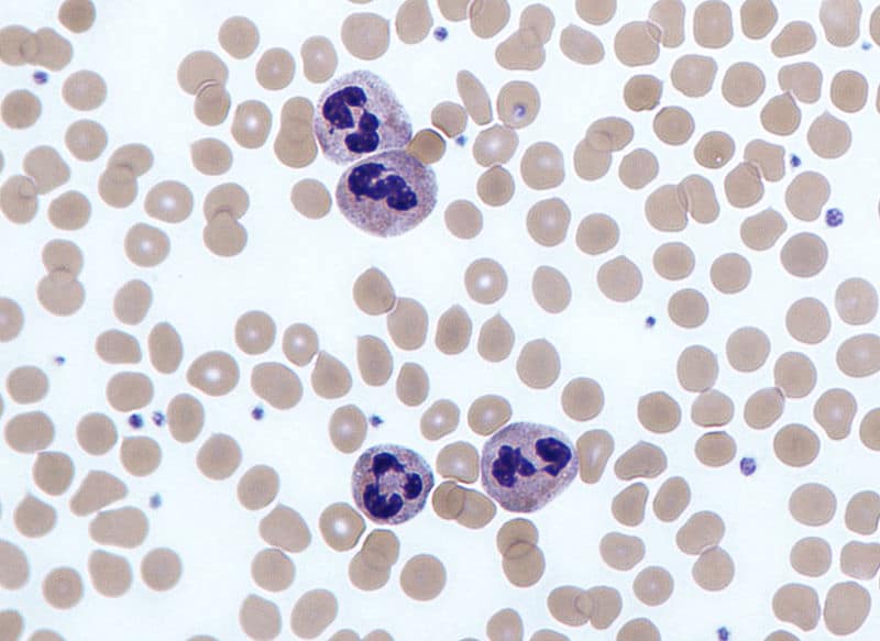 eosinophils vs neutrophils