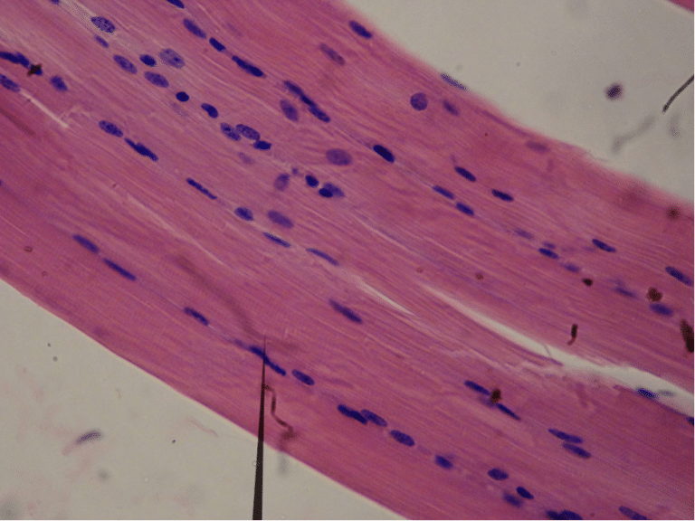 human-skeletal-muscle-structure