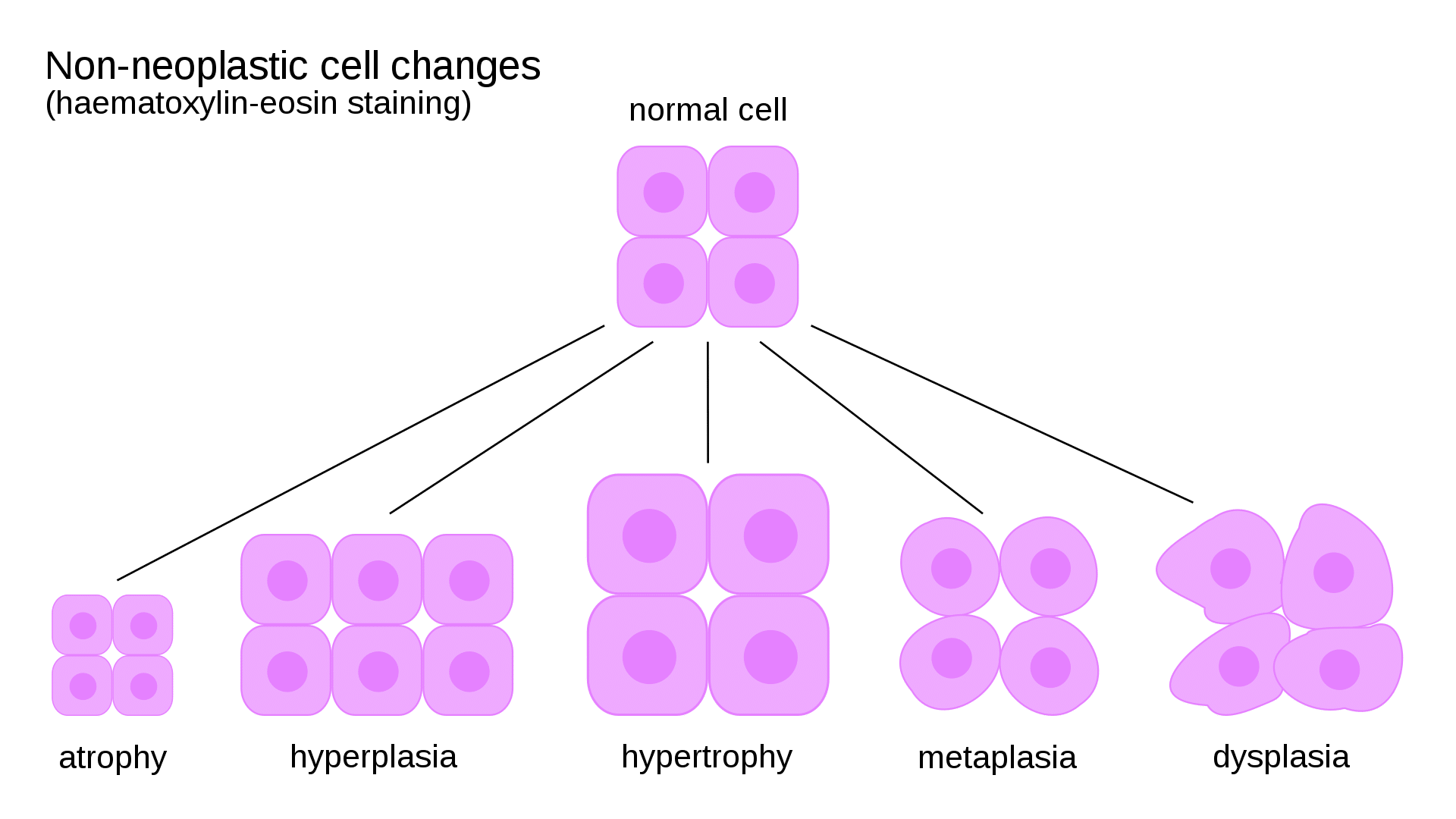 hypertrophy hypotrophy cells