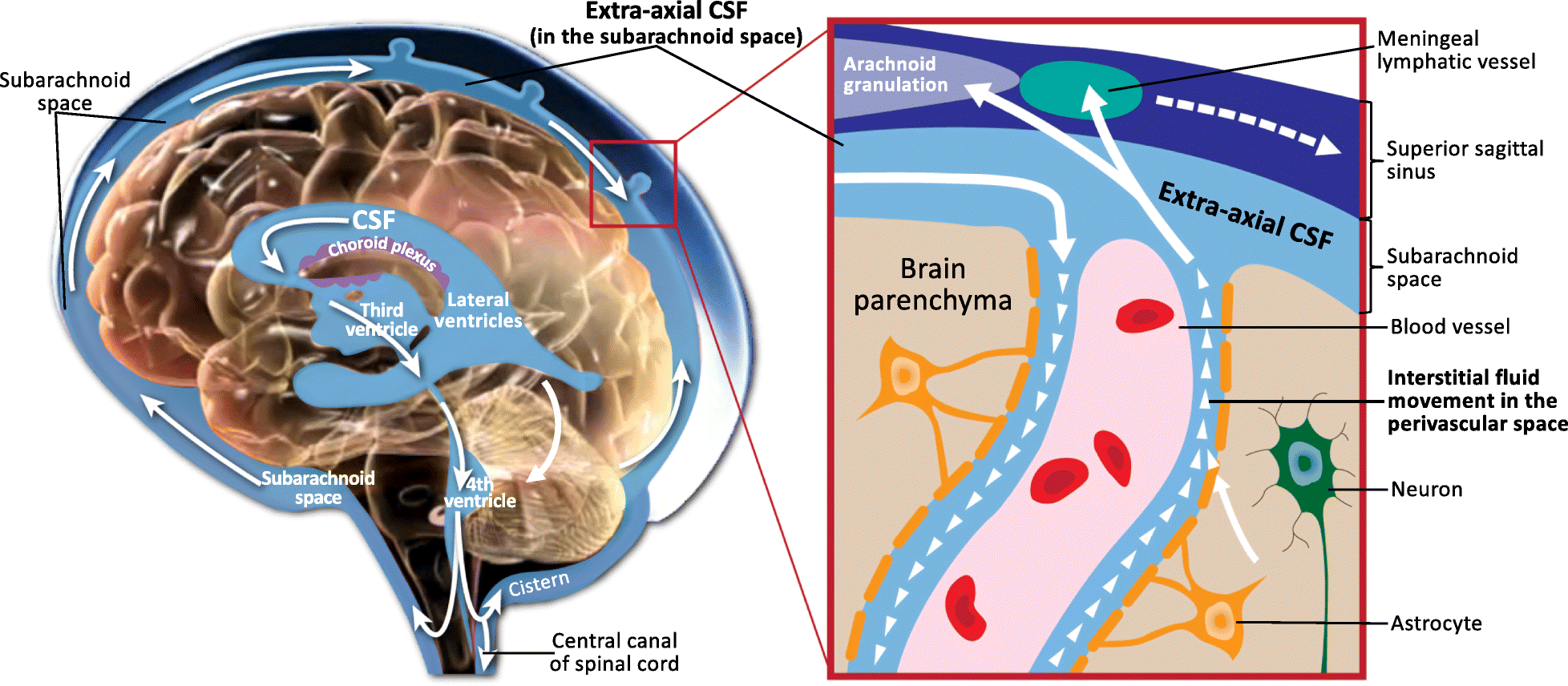 arachnoid process